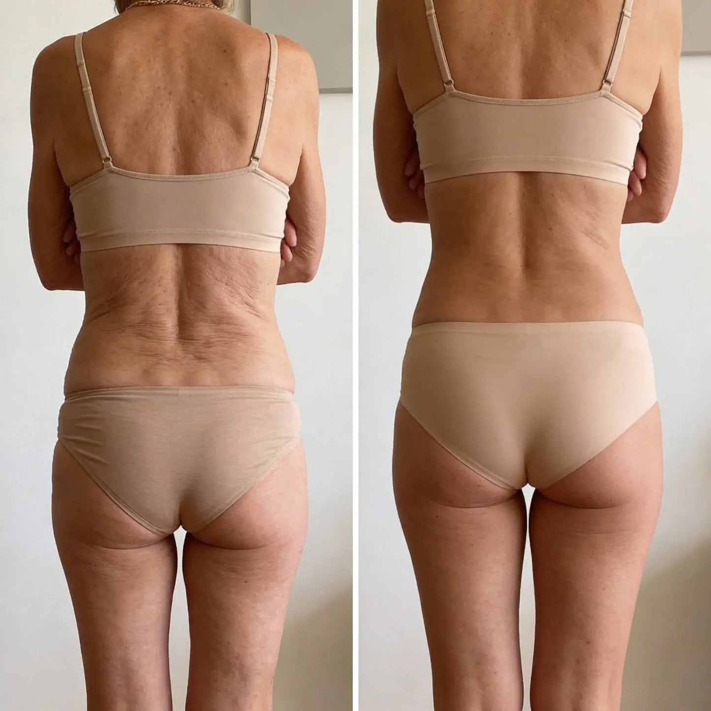 SkinBalance™ Kollagenolja | Stärker och lyfter slapp hud med 98% inom 24 timmar