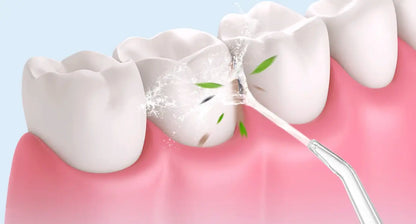 VattenFloss™ | Optimerad Vattenstråle för Tandrengöring!